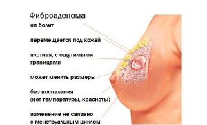 Fibroadenoma payudara: penyebab, gejala dan identifikasi, pengangkatan